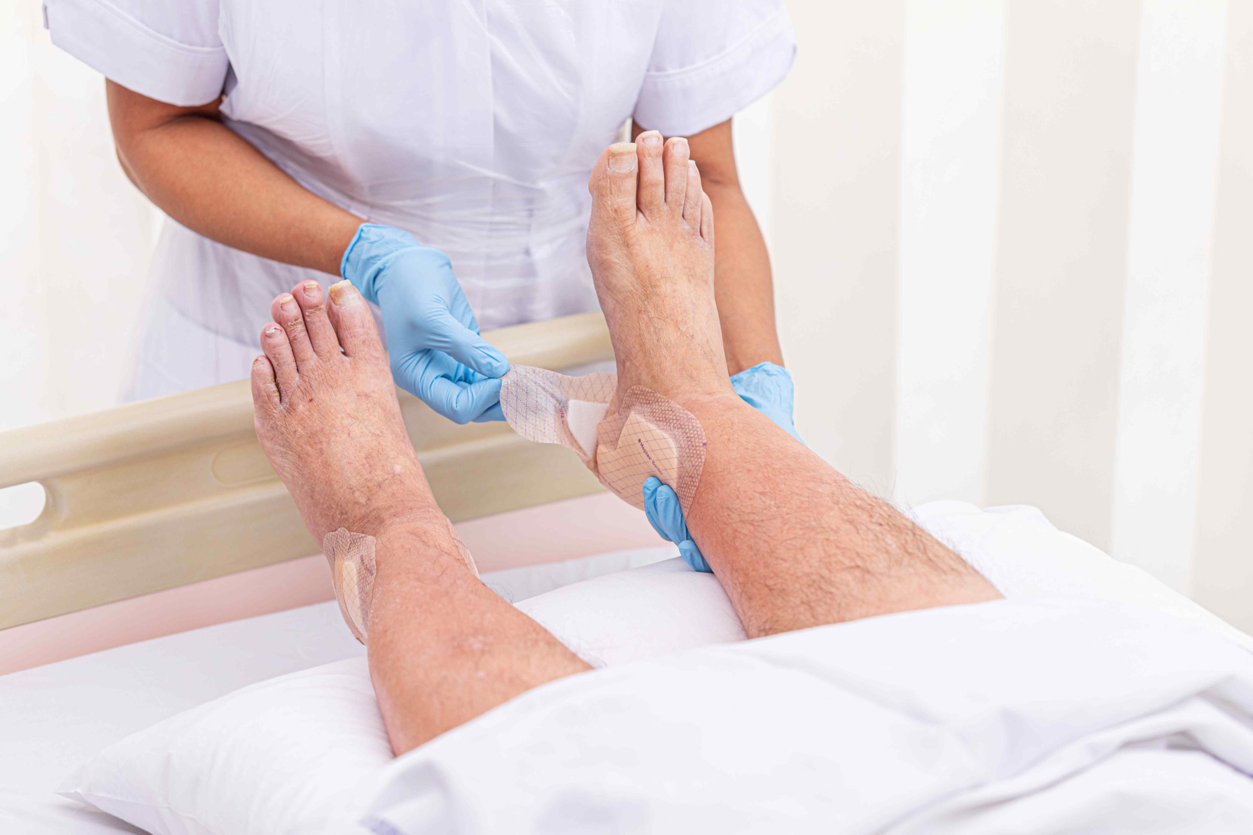 Wound dressings have a significant impact on total cost of care | Healthcare  Finance News
